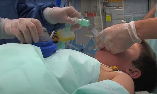 Paediatric anaesthesia using i-gel