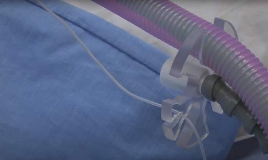 Adult and paediatric breathing system tube support overview
